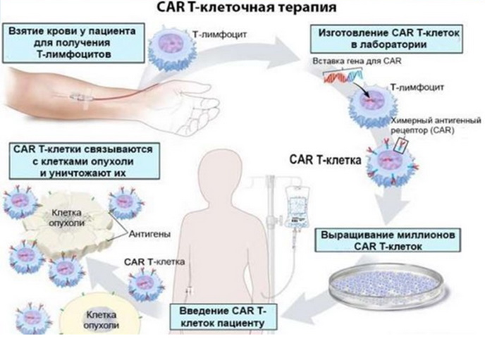 CAR-T терапия онкогематологических заболеваний